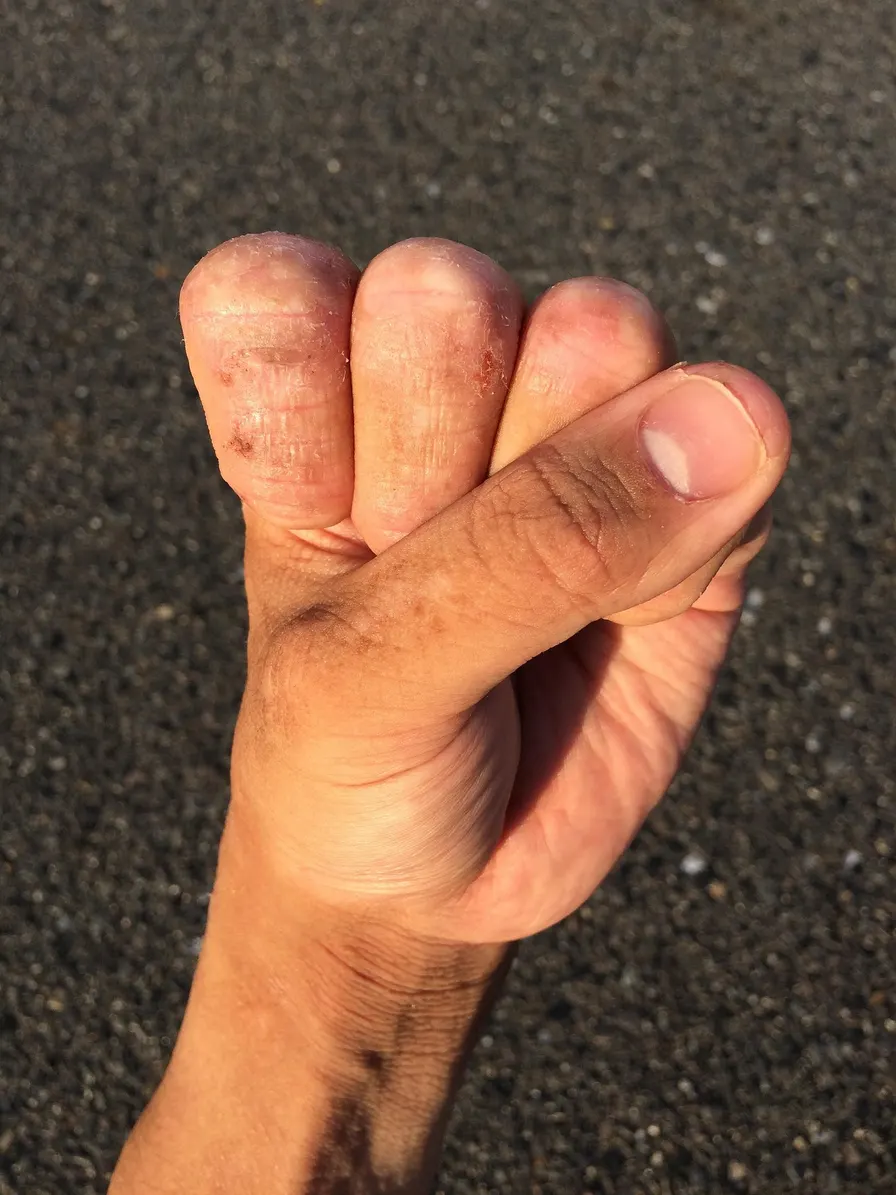 Four 2-minute grip squeezes lower resting BP by 6 mmHg